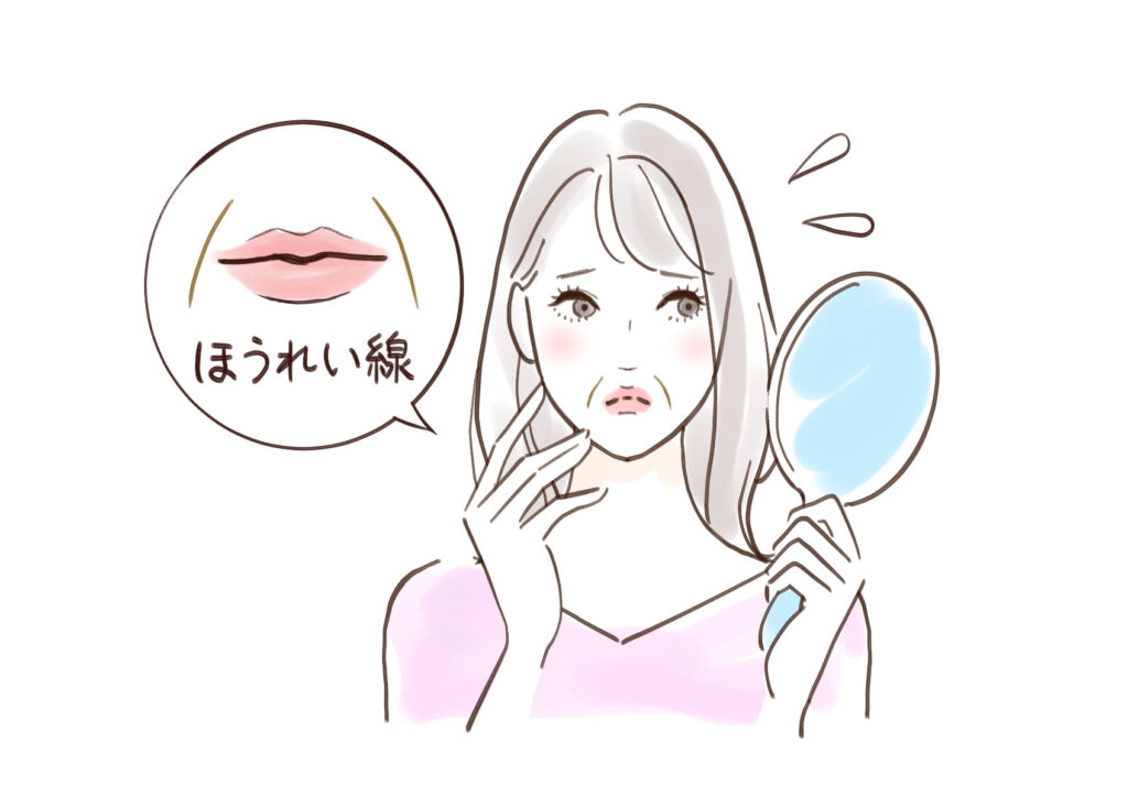 ほうれい線（鼻唇溝）の位置を顔のイラストで示した図