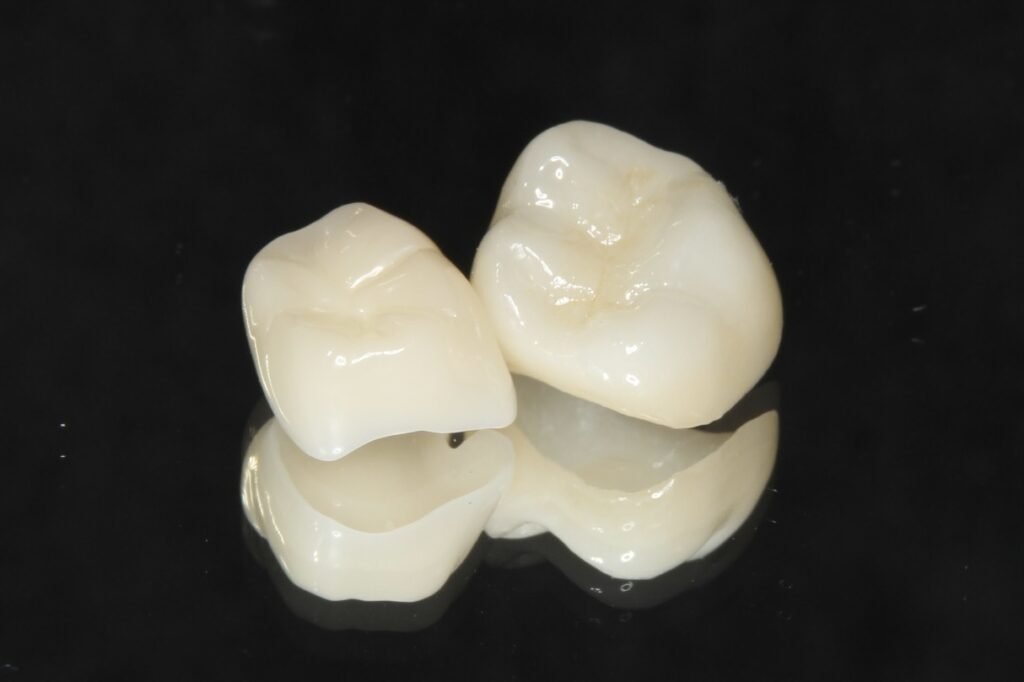 セラミック素材を用いた白い歯の補綴物のイメージ写真