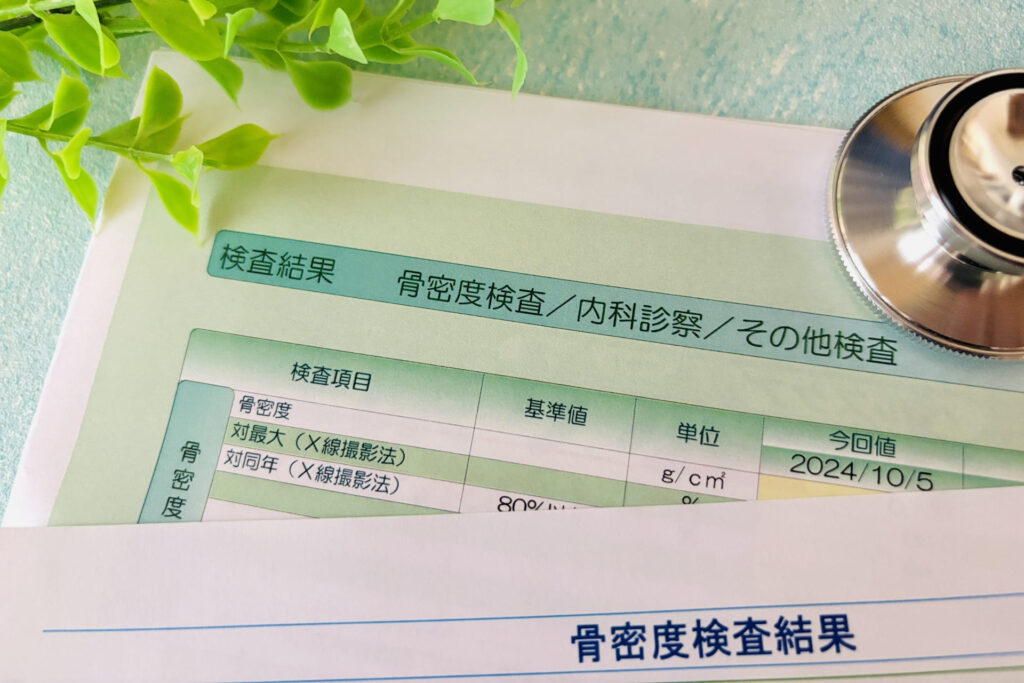 骨密度検査の結果を確認しているイメージ
