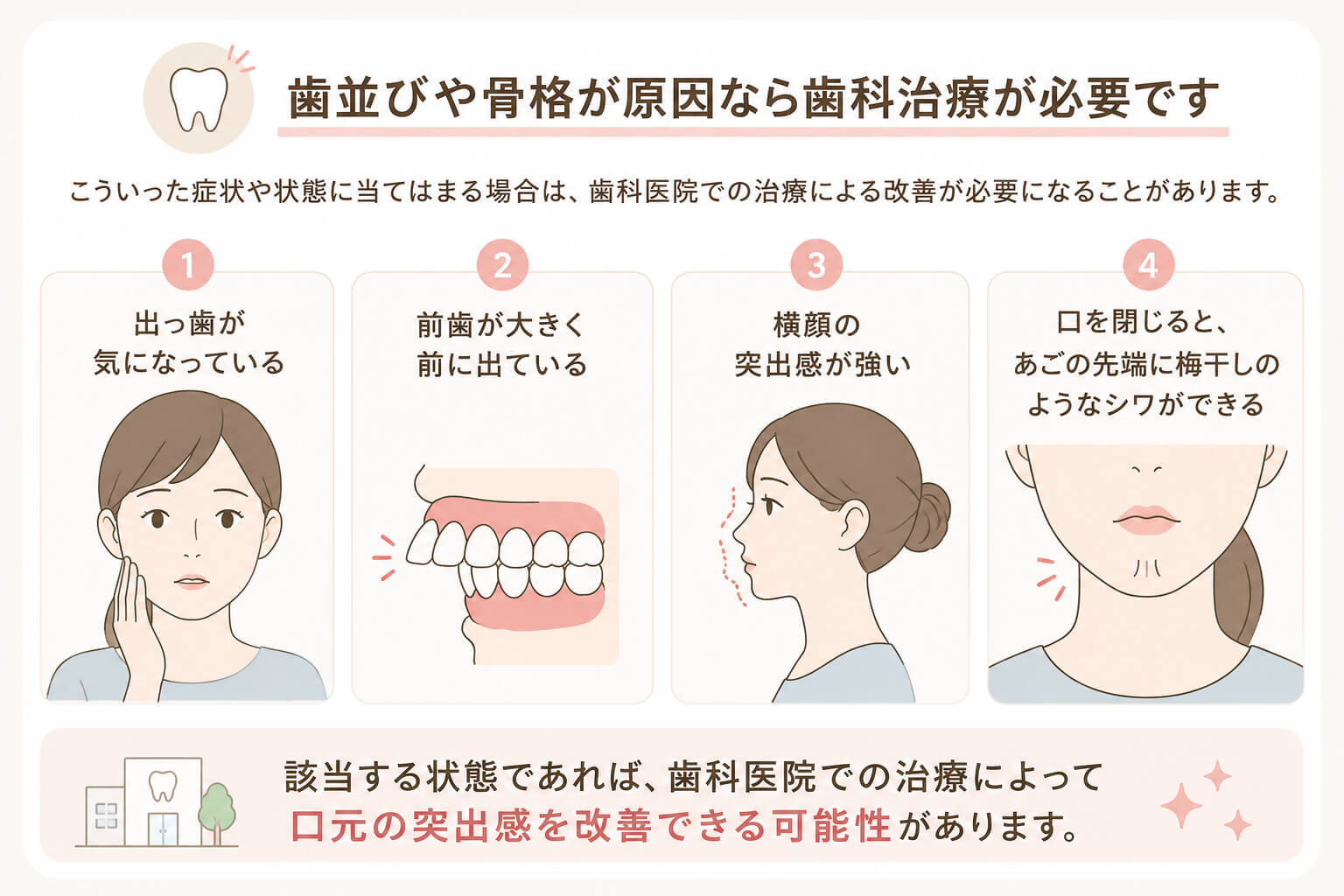 歯科治療が必要になる口元の突出症状4例の図解