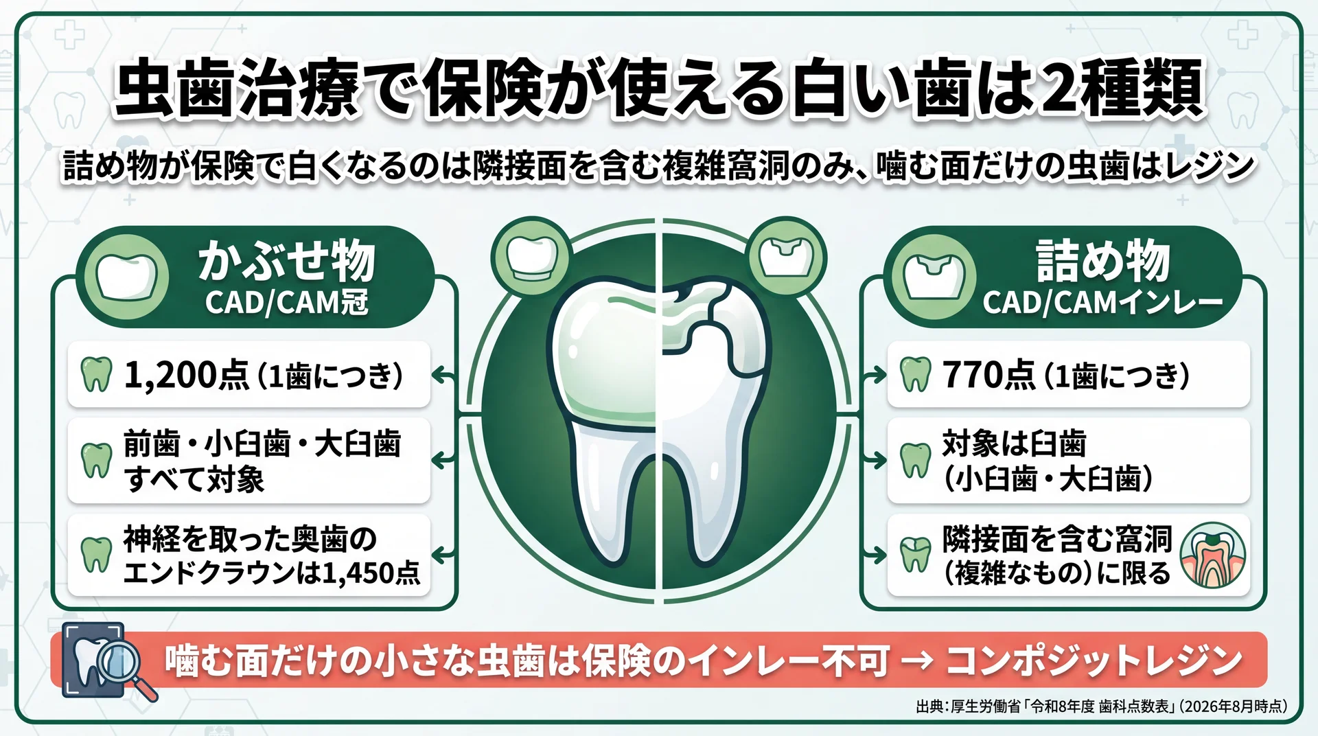 かぶせ物1,200点・詰め物770点という点数の違いと、詰め物は隣接面を含む窩洞に限られる条件を整理した図解