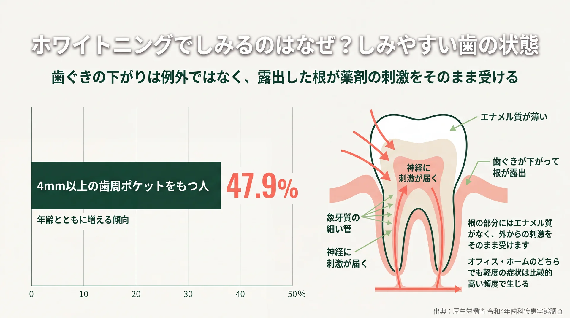 4mm以上の歯周ポケットをもつ人が47.9%にのぼることと、露出した根から神経へ刺激が届く経路を示した図