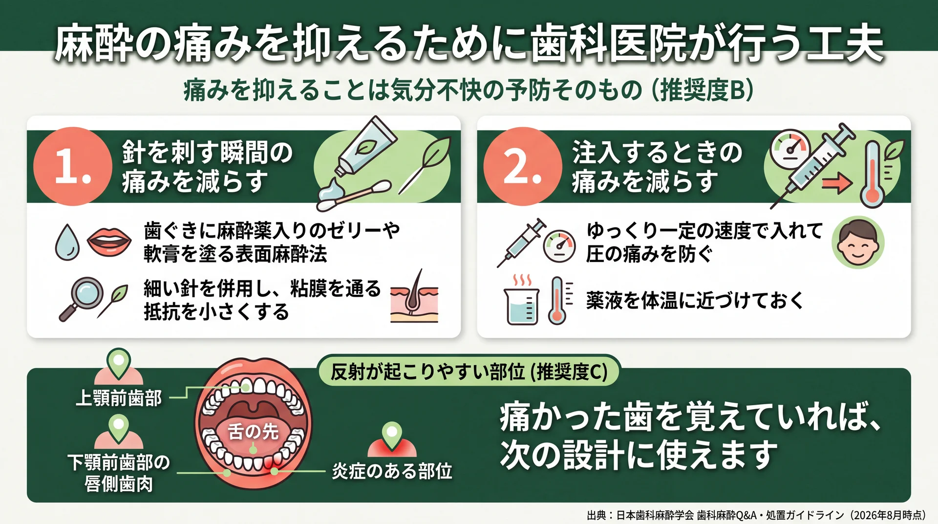 表面麻酔と細い針による刺入時対策、注入速度と薬液温度による注入時対策の2段階に加え、反射が起こりやすい4部位を口腔図で示した図