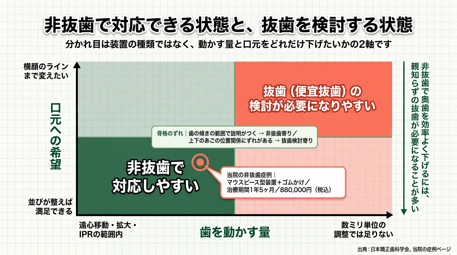 動かす量と口元をどこまで下げたいかの2軸で非抜歯ゾーンと抜歯検討ゾーンが分かれることを示す判断マップ
