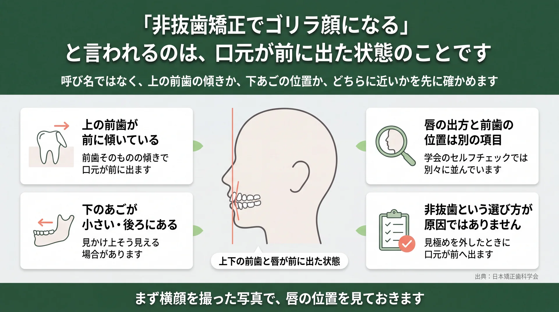 上の前歯の傾きと下あごの位置の2タイプに分けて口元の突出を整理した図解