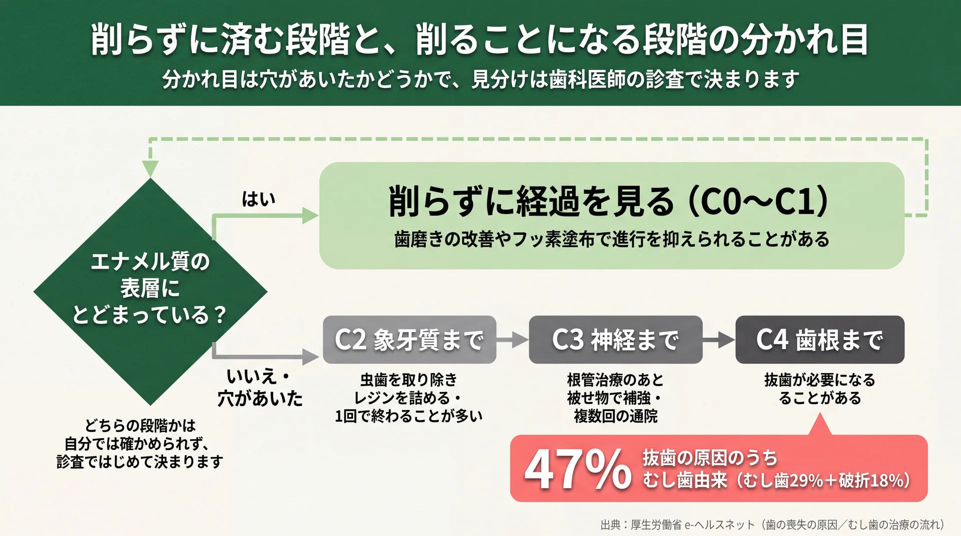 エナメル質の表層にとどまるか穴があいたかで分岐し、C2〜C4の治療内容と抜歯原因の47%を示した判断フロー図