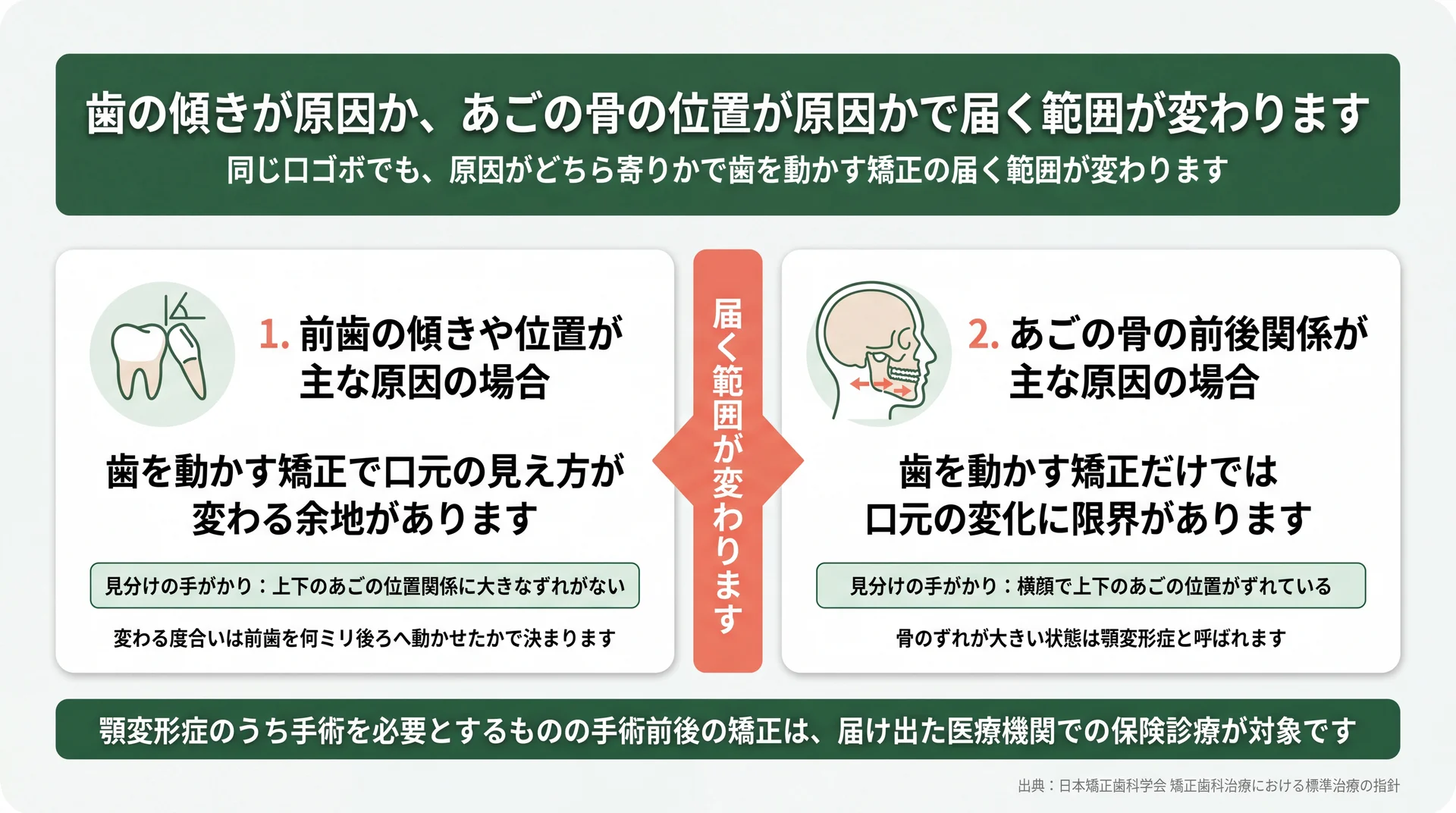 前歯の傾きが主因の場合と、あごの骨の前後関係が主因の場合で歯を動かす矯正の届く範囲が変わることを整理した図