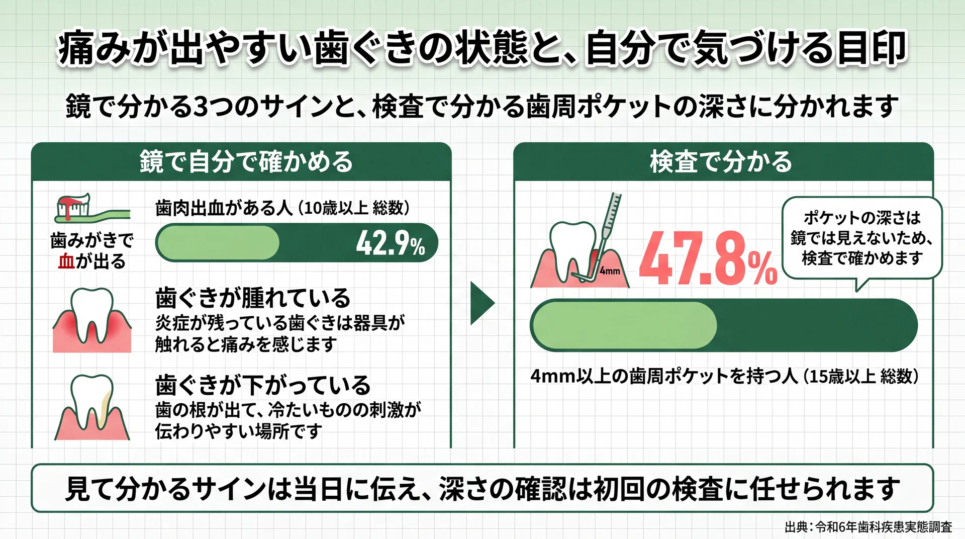 歯肉出血と4mm以上の歯周ポケットの割合、鏡で確かめられる3つのサインを対比した図